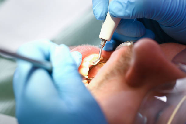 Best Emergency Dental Extractions in Allendale, MI