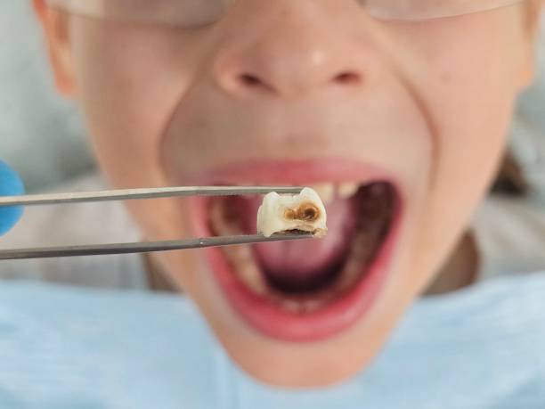 Best Emergency Dentist for Knocked-Out Tooth in Allendale, MI