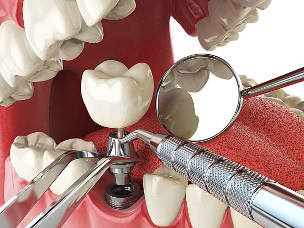 Best Orthodontic Emergency Dentist in Allendale, MI